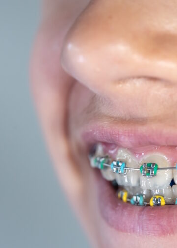 ortodonta wskazania do wizyty